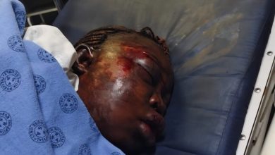 Desree Mohau Letsoalo critically injured by ex-husband Josias in Mokgoloboto village Tzaneen on Saturday 18 October
