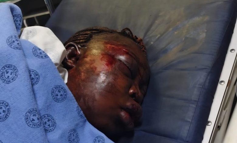 Desree Mohau Letsoalo critically injured by ex-husband Josias in Mokgoloboto village Tzaneen on Saturday 18 October