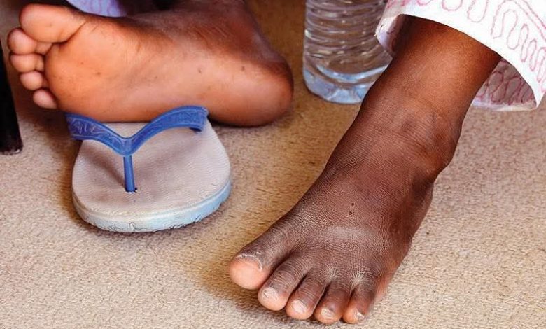 Former Limpopo constable jailed for 8 years at Middleburg court for 2020 rape of 12-year-old son
