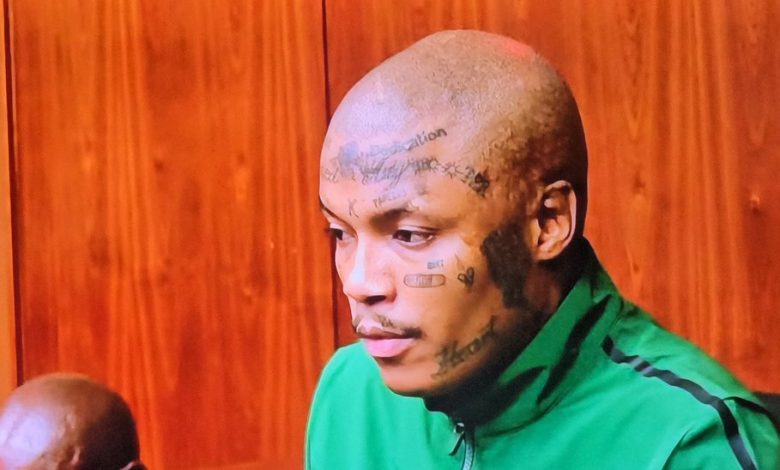 Bail Battle: Shebeshxt Needs Urgent Leg Surgery Ahead of Court Release